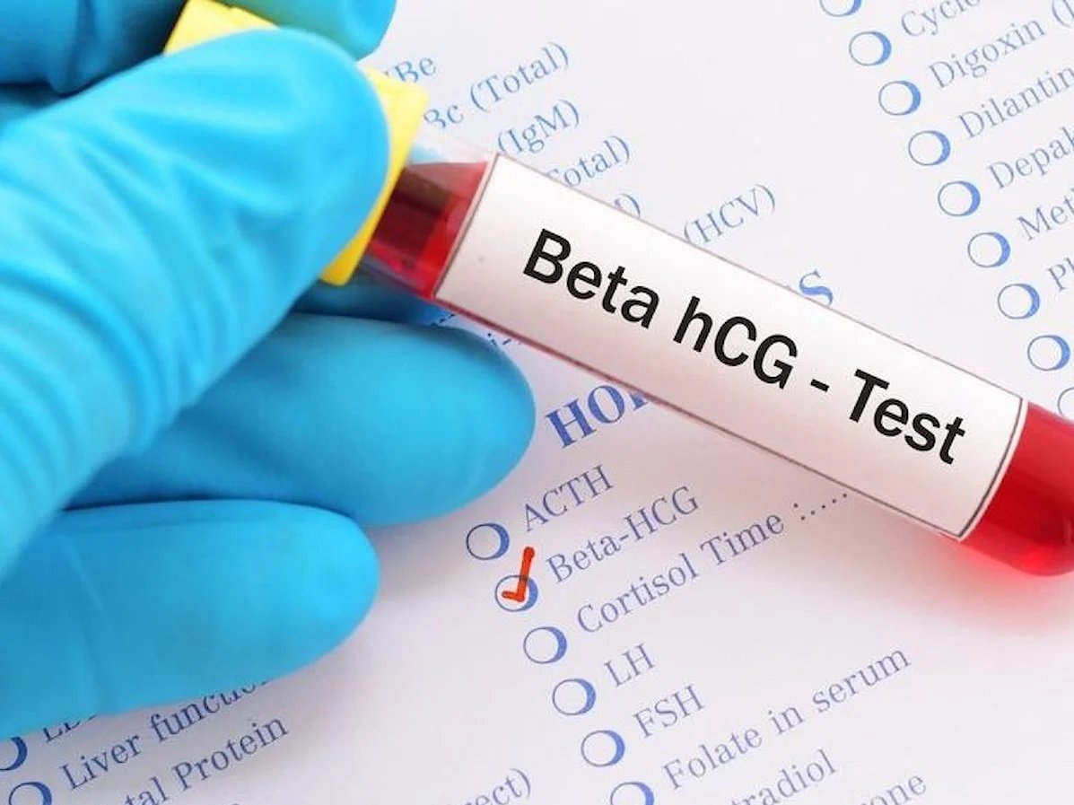 Beta HCG