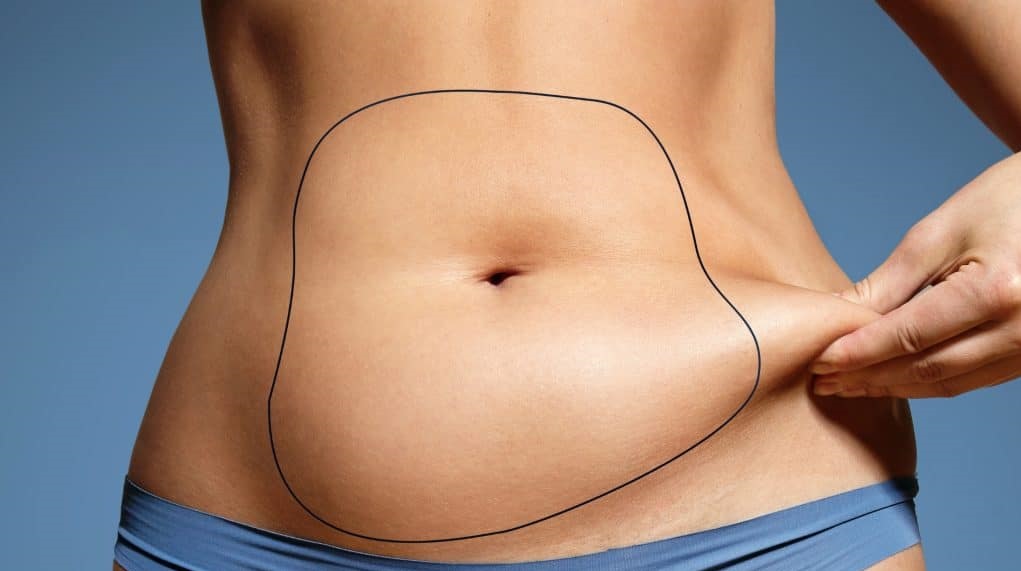 Yağ Aldırma Ameliyatı (Liposuction) Nedir, Nasıl Yapılır? Anne Gebe
