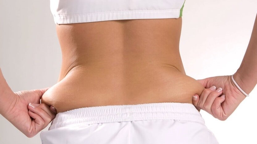 Liposuction nedir